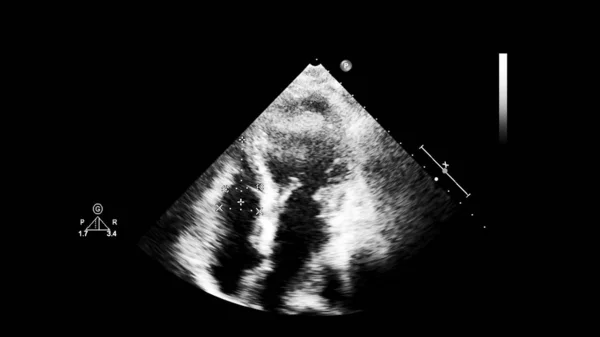 Kalp görüntüsü ne reisi olan bir ultrason makinesinin ekranı. — Stok fotoğraf
