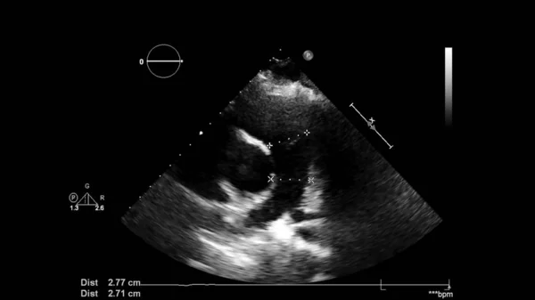 Scherm van een ultrasone machine met een hart beeld. — Stockfoto