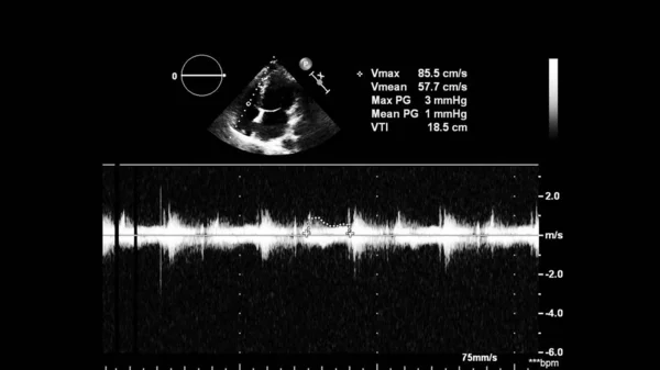 Obrazovka ultrazvukového zařízení s obrazem srdce. — Stock fotografie