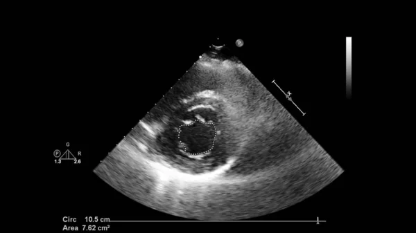 Экран ультразвукового аппарата с изображением сердца . — стоковое фото