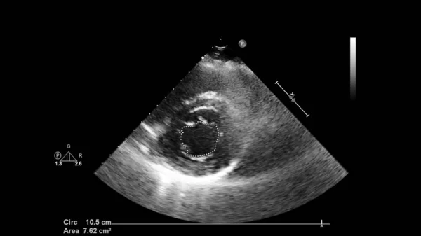 Tela de uma máquina de ultrassom com uma imagem de coração . — Fotografia de Stock