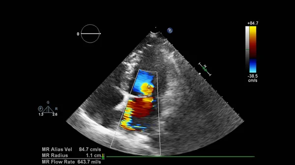 Scherm van een ultrasone machine met een hart beeld. — Stockfoto