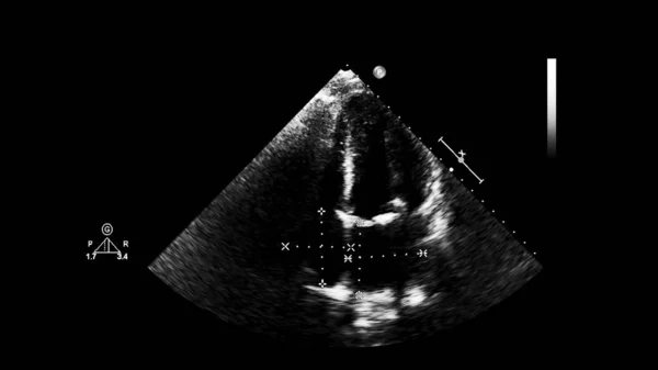 Screen of an ultrasound machine with a heart image. — Stock Photo, Image