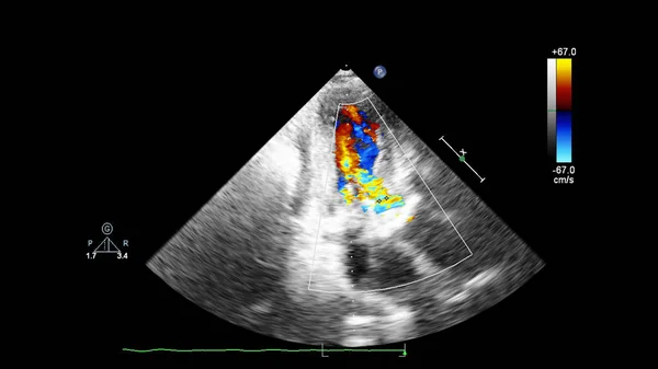 Obrazovka ultrazvukového zařízení s obrazem srdce. — Stock fotografie