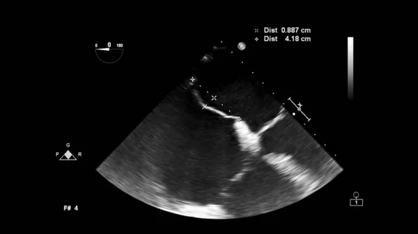 Écran d'une machine à ultrasons avec une image cardiaque . — Photo