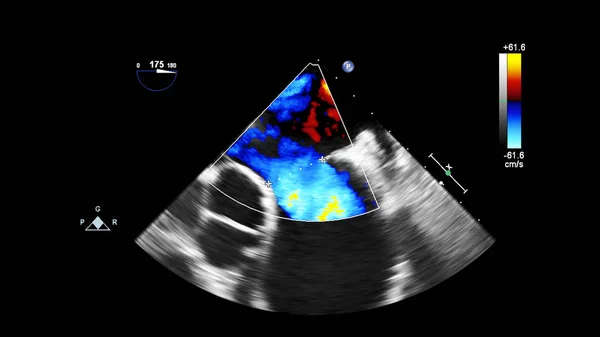 Scherm van een ultrasone machine met een hart beeld. — Stockfoto