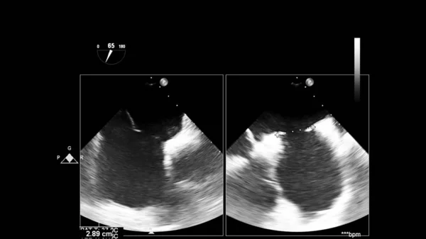 Écran d'une machine à ultrasons avec une image cardiaque . — Photo