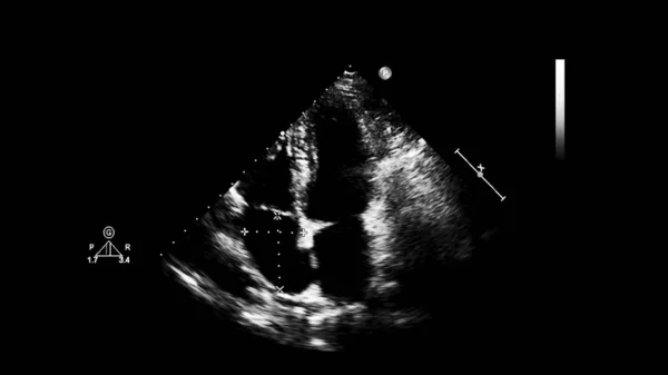 Kalp görüntüsü ne reisi olan bir ultrason makinesinin ekranı. — Stok fotoğraf