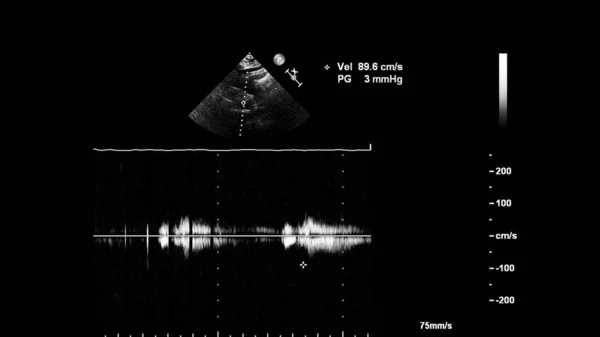 Ekran ultradźwiękowej maszyny z obrazem serca. — Zdjęcie stockowe