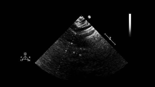 Scherm van een ultrasone machine met een hart beeld. — Stockfoto