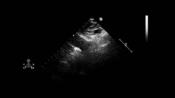 Изображение Сердца Сером Режиме Время Трансофагеального Ультразвука — стоковое фото
