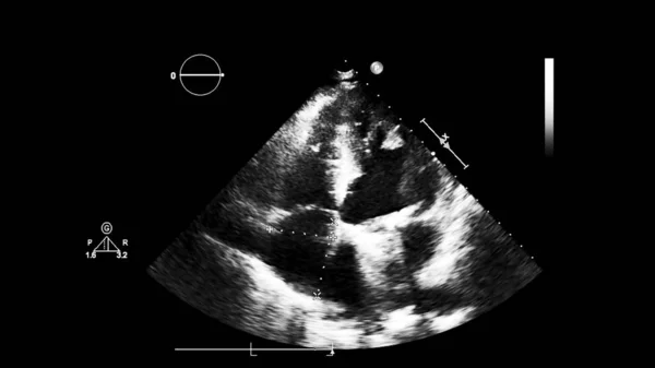 Изображение Сердца Сером Режиме Время Трансофагеального Ультразвука — стоковое фото