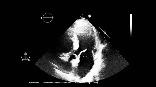 経食道超音波検査時のグレースケールモードで心臓の画像 — ストック写真