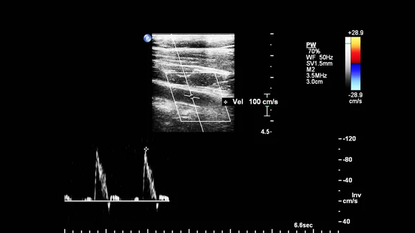 Nabız Dalgası Doppler Ultrason Denetimi — Stok fotoğraf