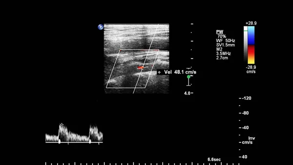 Nabız Dalgası Doppler Ultrason Denetimi — Stok fotoğraf