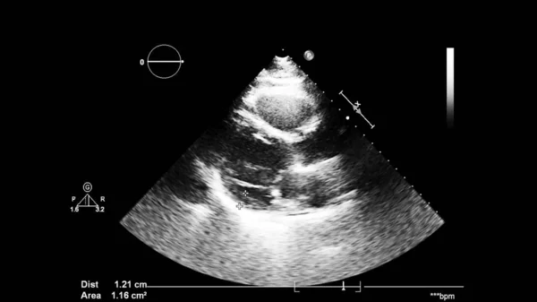 Изображение Сердца Сером Режиме Время Трансофагеального Ультразвука — стоковое фото