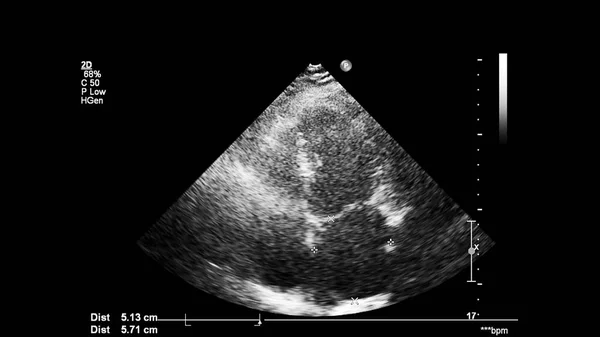 Изображение Сердца Сером Режиме Время Трансофагеального Ультразвука — стоковое фото