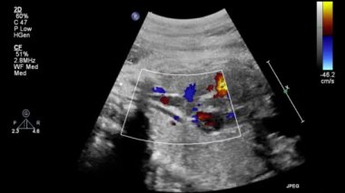 Fetal kalbin ultrason muayenesi.