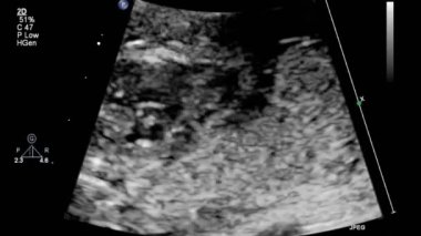 Fetal kalbin ultrason muayenesi.