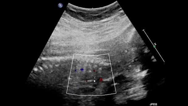 Echografie Onderzoek Van Het Foetale Hart — Stockvideo