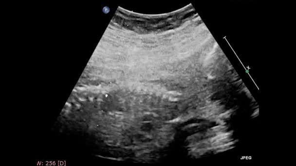 Ultrasound Examination Fetal Heart — Stock Video