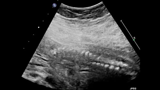 Ultraschalluntersuchung Des Fetalen Herzens — Stockvideo