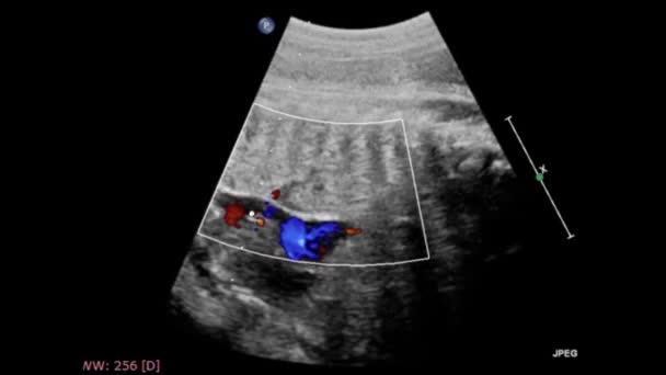 Fetal Kalbin Ultrason Muayenesi — Stok video