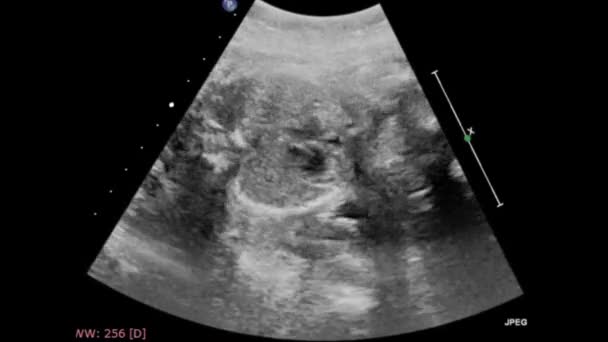 Exame Ultrassonográfico Coração Fetal — Vídeo de Stock