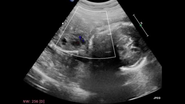 Echografie Onderzoek Van Het Foetale Hart — Stockvideo