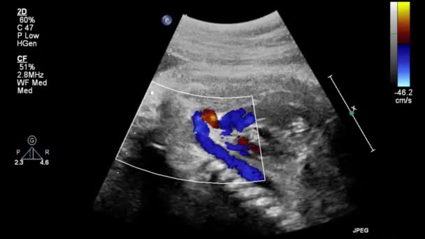 Esame Ecografico Del Cuore Fetale — Video Stock