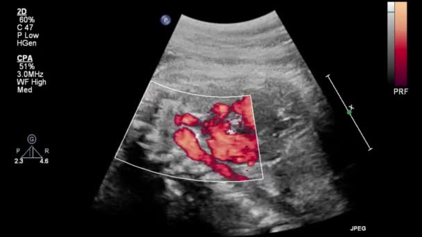 胎儿心脏的超声检查 — 图库视频影像