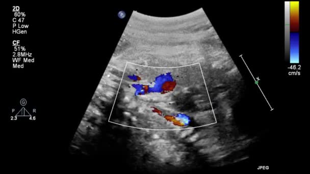 胎児心臓の超音波検査 — ストック動画