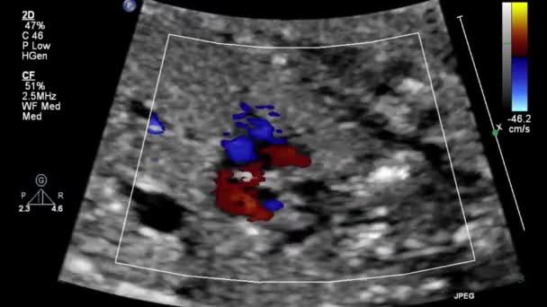 Ecografía Del Corazón Fetal — Vídeo de stock