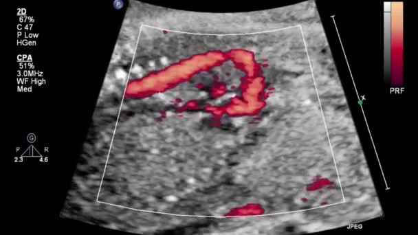 胎儿心脏的超声检查 — 图库视频影像