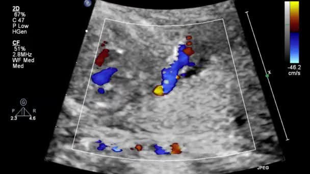 Ultrasound Examination Fetal Heart — Stock Video