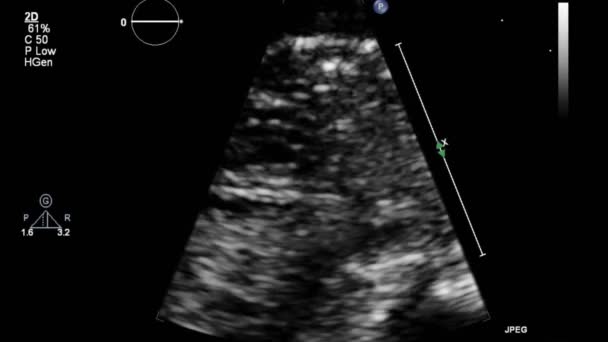 Ultrasound Examination Fetal Heart — Stock Video