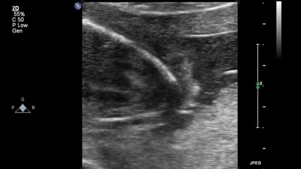 Ultrasound Memeriksa Jantung Janin — Stok Video