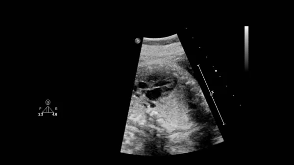 태아 심초음파를 가진 초음파 스크린. — 스톡 사진