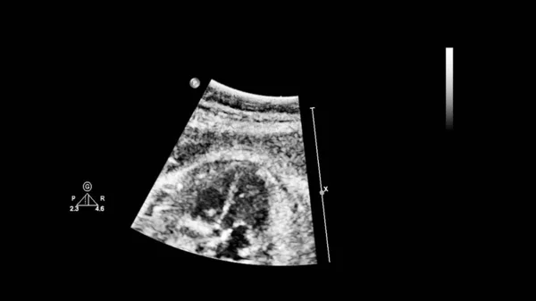 Fetal ekokardiyografi ile ultrasonografi ekranı. — Stok fotoğraf