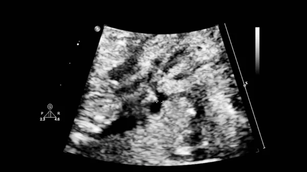 Fetal ekokardiyografi ile ultrasonografi ekranı. — Stok fotoğraf