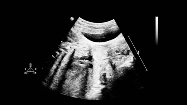 Ultrazvuková obrazovka s fetální echokardiografií. — Stock fotografie