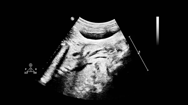 Ultrasound screen with fetal echocardiography. — Stock Photo, Image