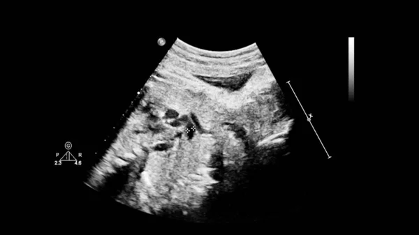 Ultraschallbild mit fetaler Echokardiographie. — Stockfoto