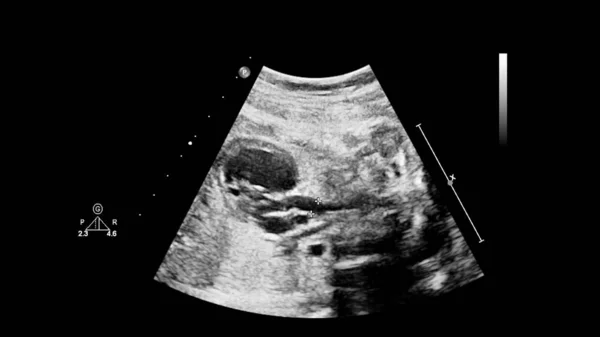 Ecografía con ecocardiografía fetal . —  Fotos de Stock