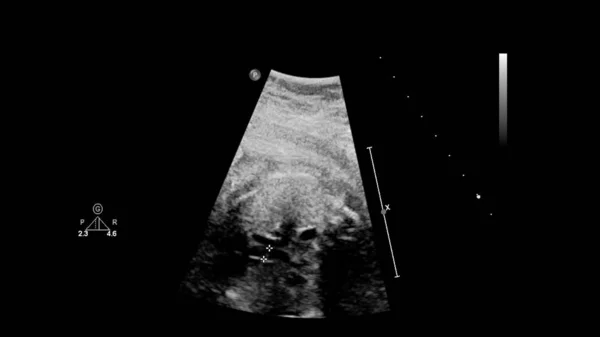 Echografie scherm met foetale echocardiografie. — Stockfoto