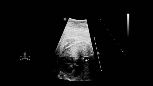 Ecografía con ecocardiografía fetal . — Foto de Stock