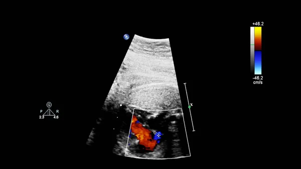 Fetal ekokardiyografi ile ultrasonografi ekranı. — Stok fotoğraf