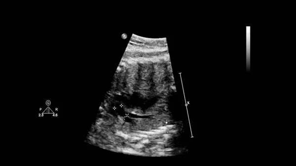 Ultrasound screen with fetal echocardiography. — Stock Photo, Image