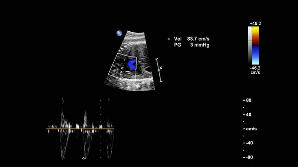 Ecografía con ecocardiografía fetal . —  Fotos de Stock