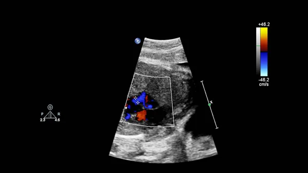 Fetal ekokardiyografi ile ultrasonografi ekranı. — Stok fotoğraf